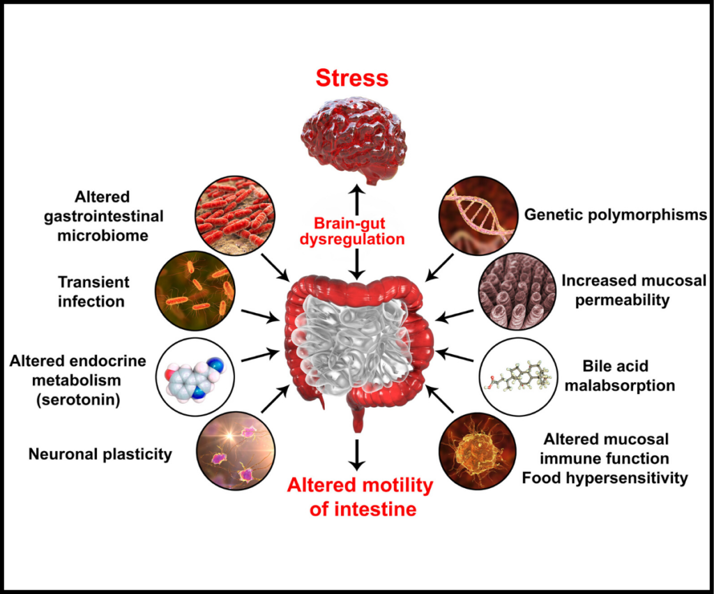 Graphic-describing-how-stress-affect-the-gut